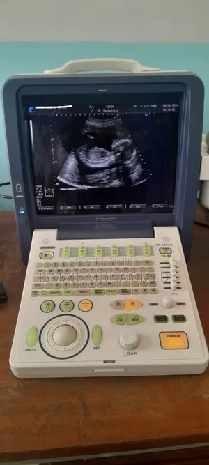 Photo - Fukuda Uf-450ax Ultrasound Machine