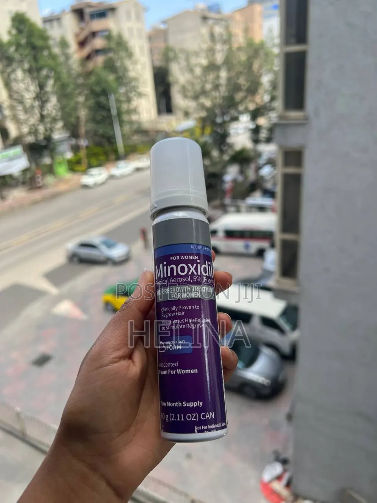 የወንዶችን ሚኖክሲዲል ስትጠቀሙ ለነበራቹ ሴቶች ለእናንተ ተብሎ የተዘጋጀዉን Minoxidil አስገብተንላችዋል