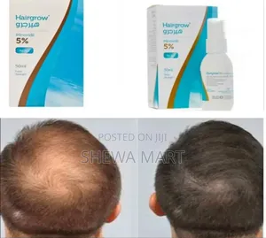 Photo - Hairgrow Minoxidil 5% ጥራቱን የጠበቀ የፀጉር ማሳደጊያ አቀረብንልዎ!! Minoxidil በ