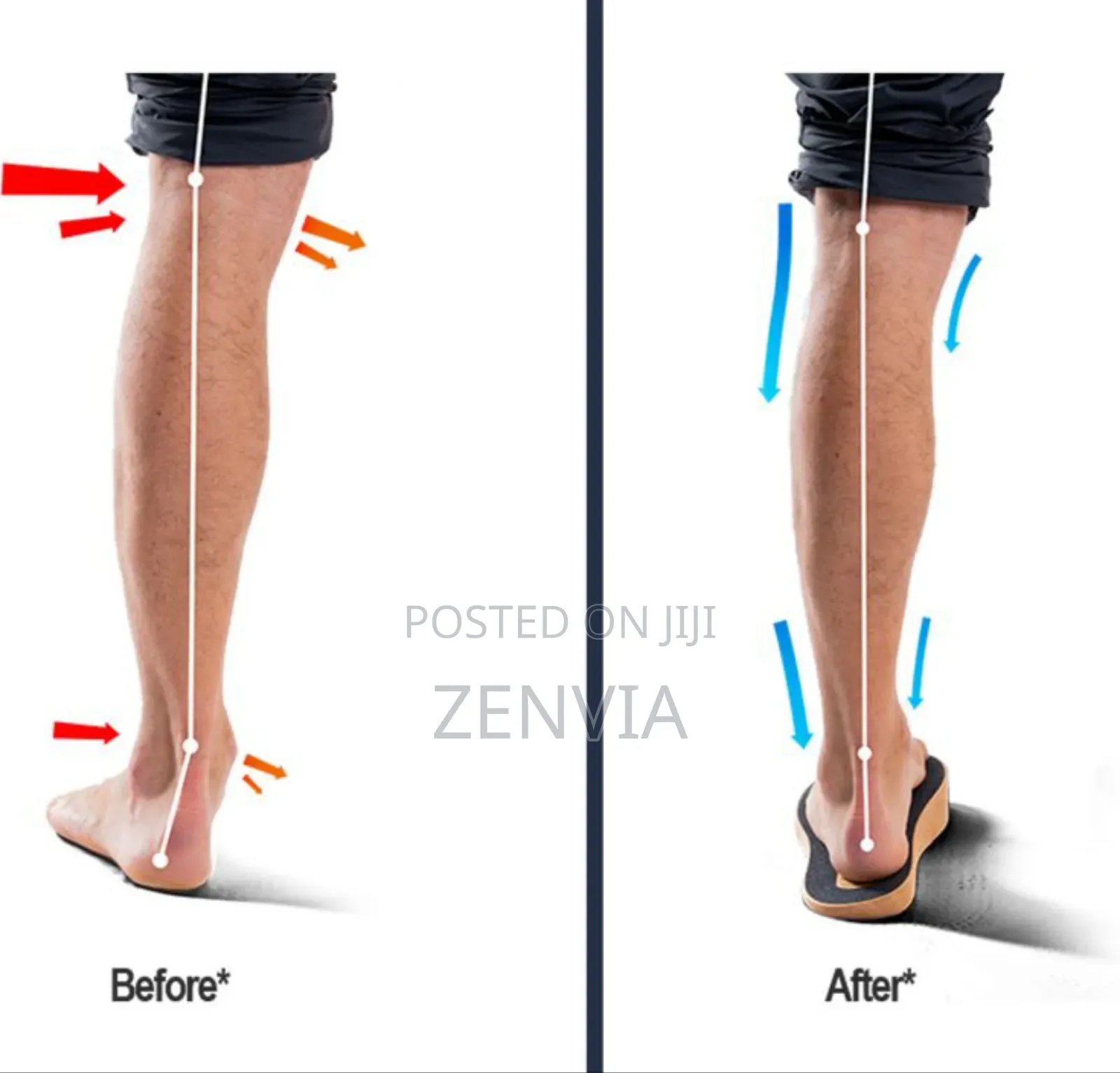 Unisex Flat Foot Orthodontics Insole / Free Delivery/