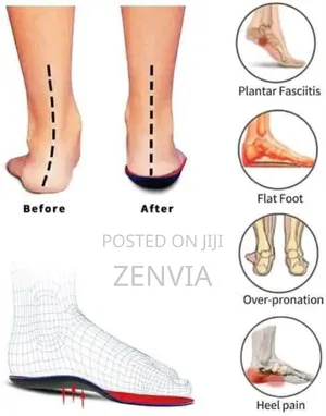 Unisex Flat Foot Orthodontics Insole / Free Delivery/