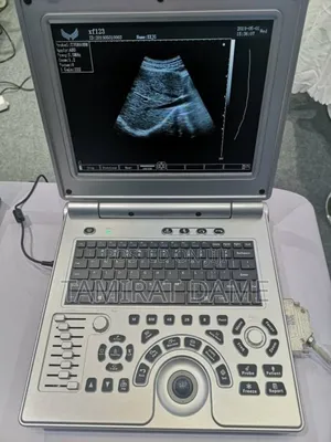 Photo - Xf Portable Ultrasound