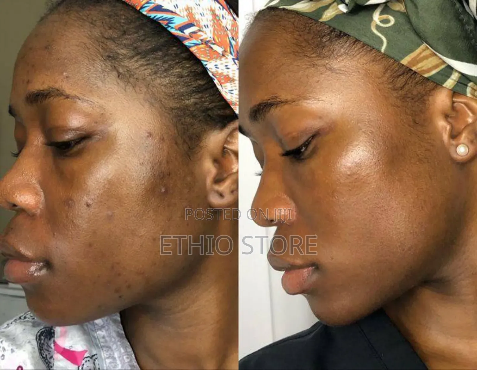 Medi-Peel Melanon X Cream