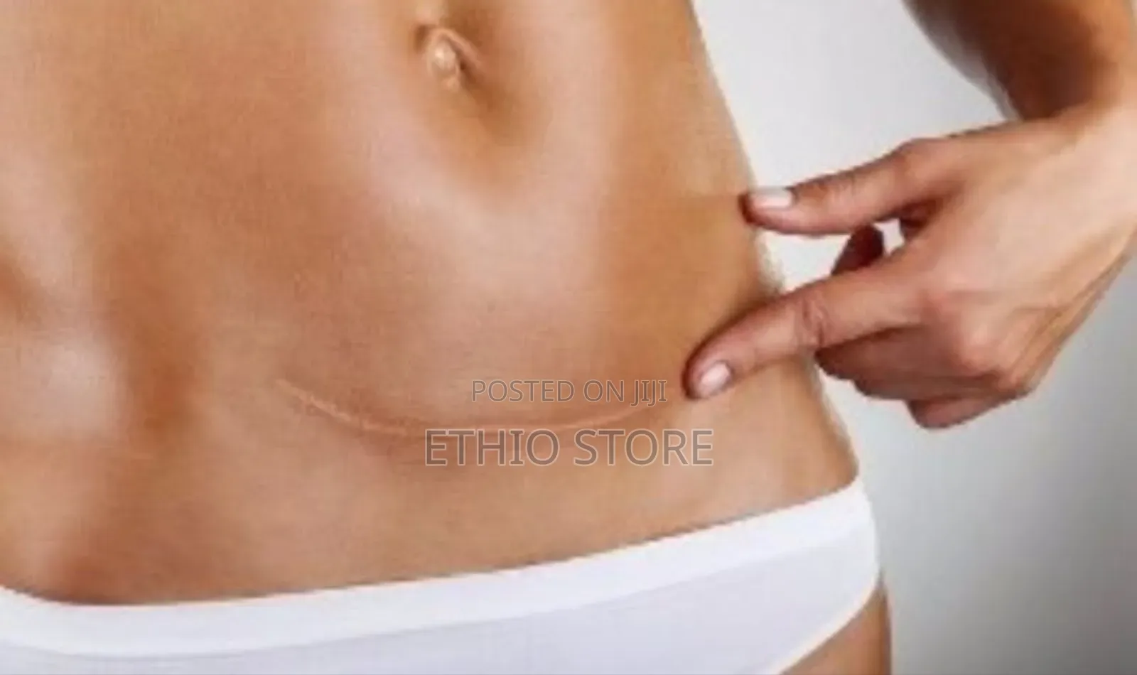 Jaysuing Silicone Scar Gel