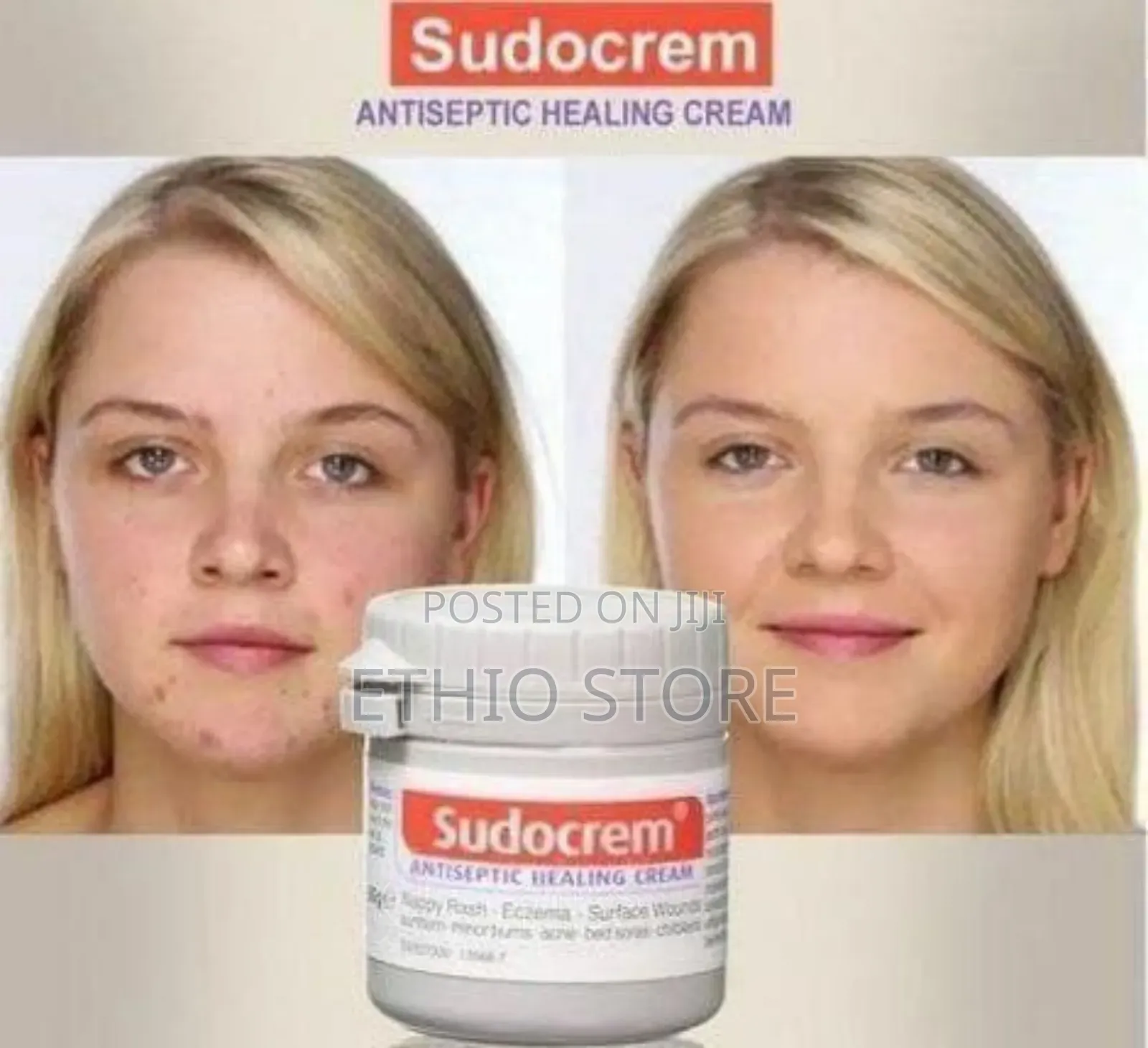 Sudocrem Antiseptic Healing Cream