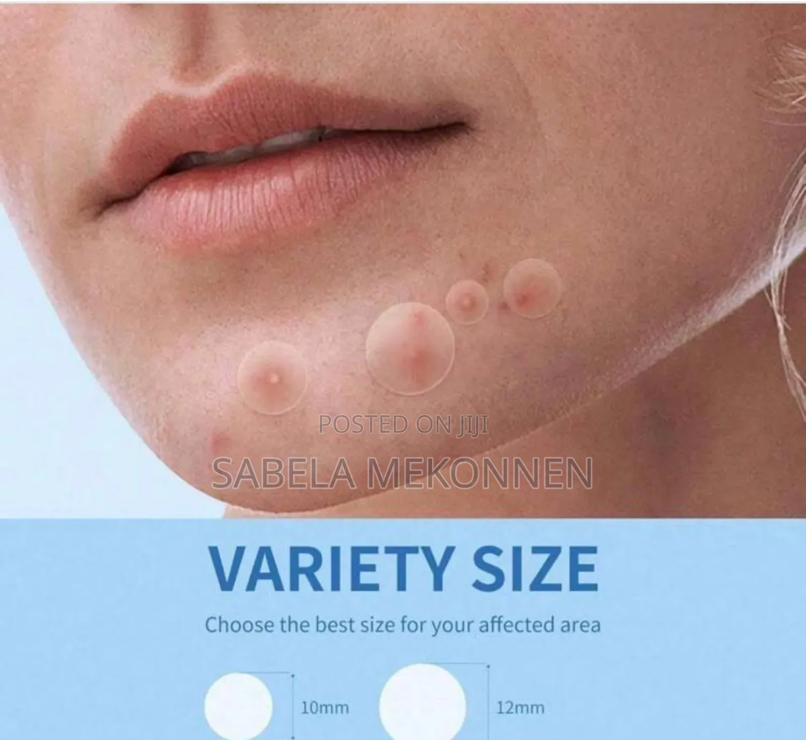 Transparent Pimple Patch