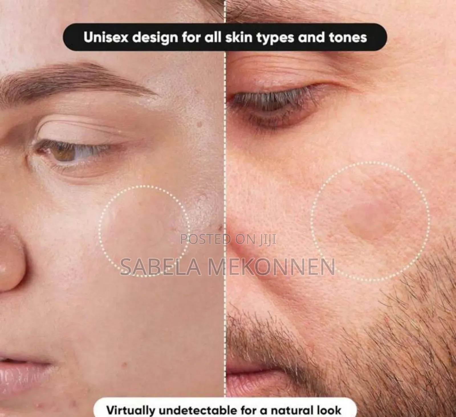 Transparent Pimple Patch