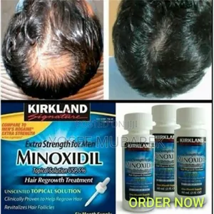 Photo - በራስ መተማመንዎን ከፍ የሚያደርግ ሚኖክሲዲል