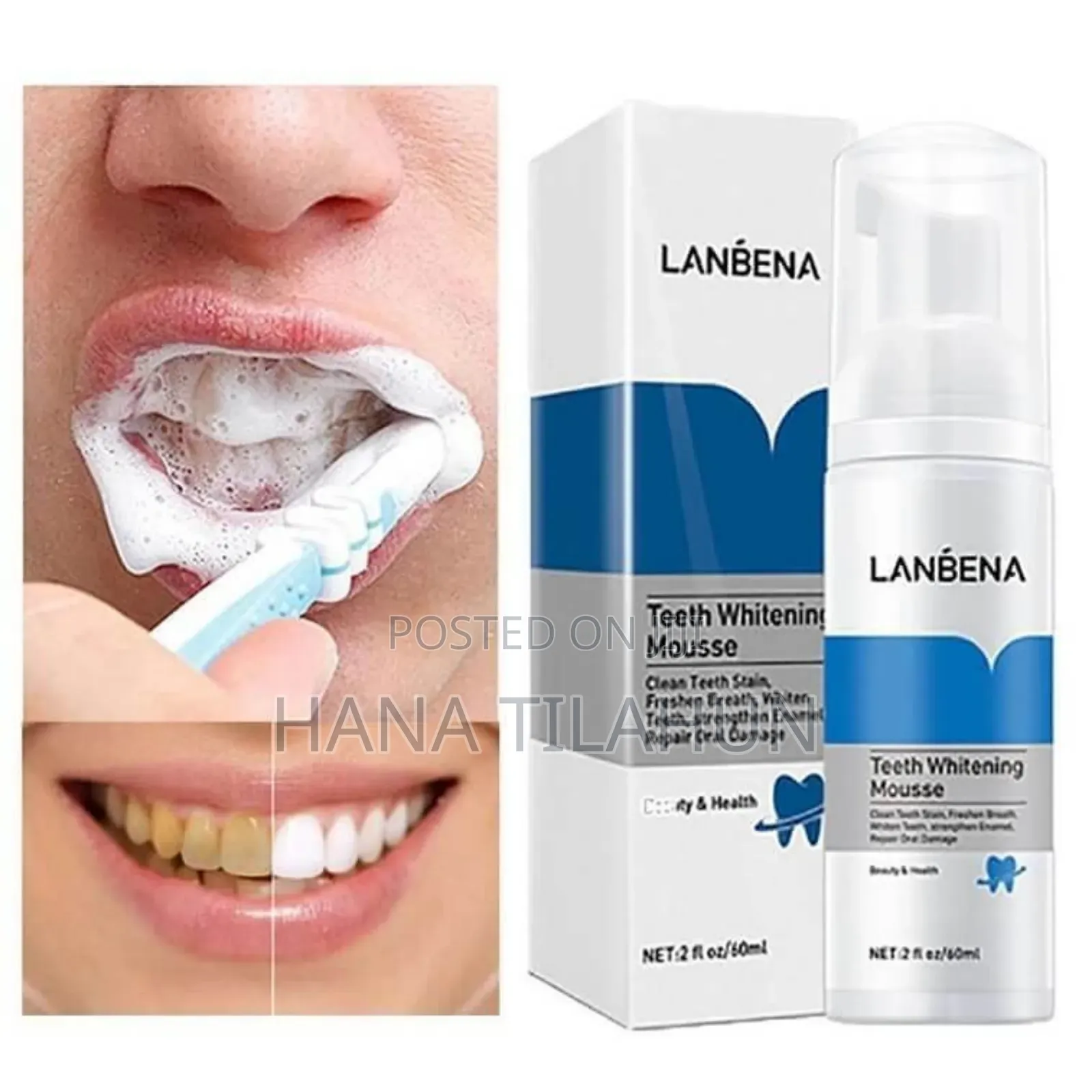 Lanbena Teeth Whitening