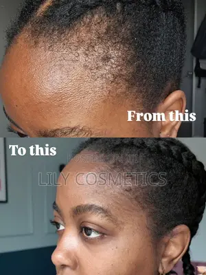 Kirkland Minoxidil 5% Solution