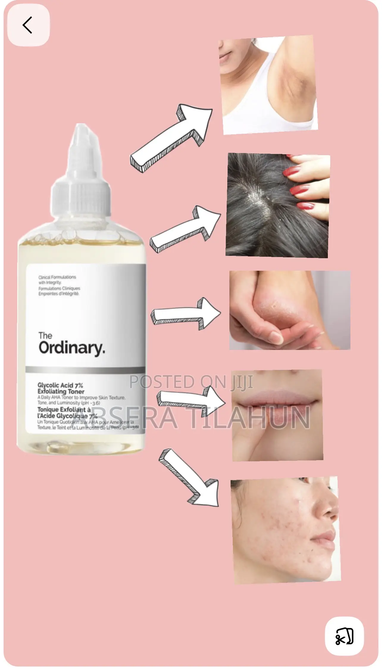 Ordinary’S Glycolic Acid and Niacinamide