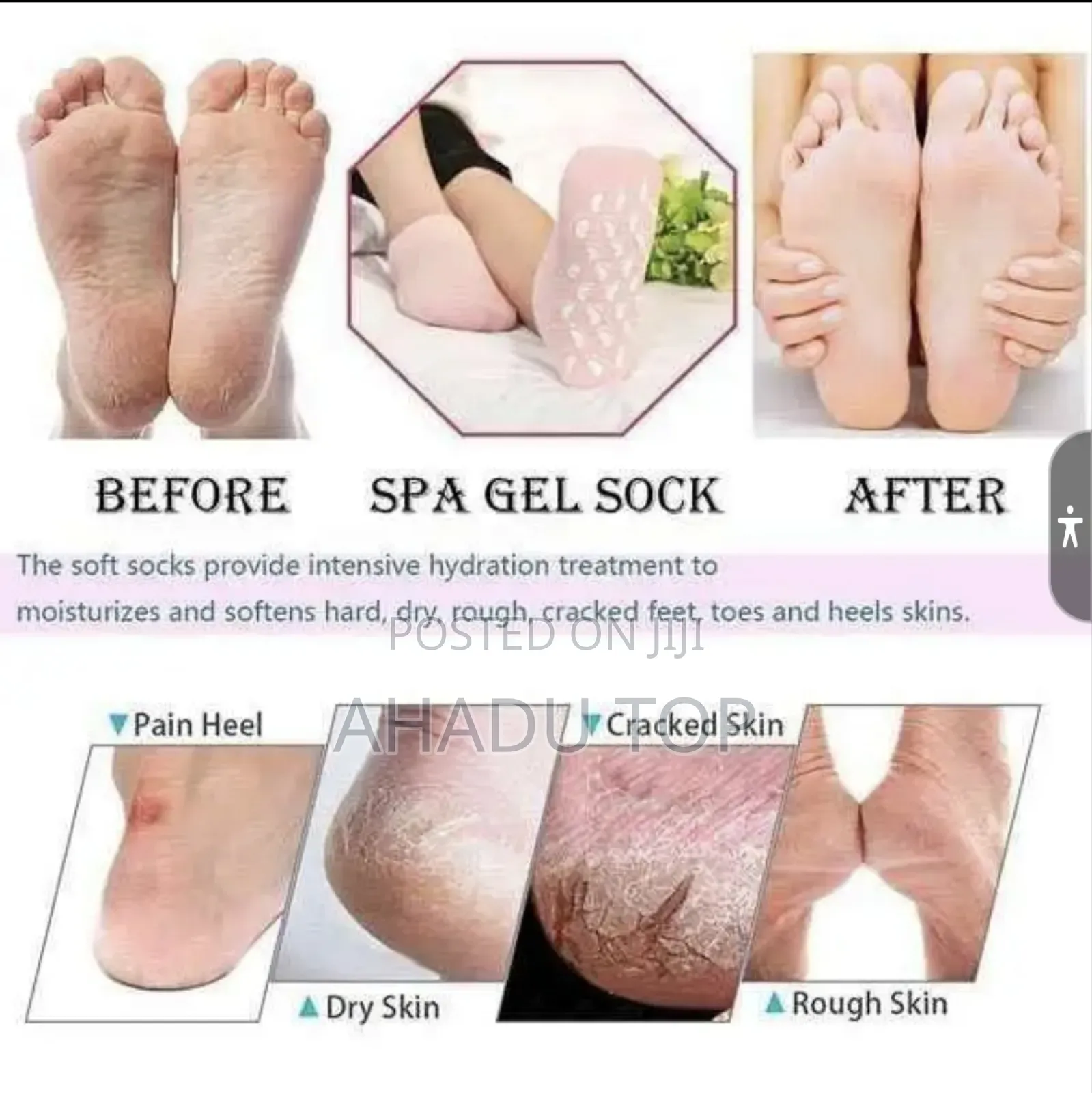 Soft Moisturing Gel Foot Care