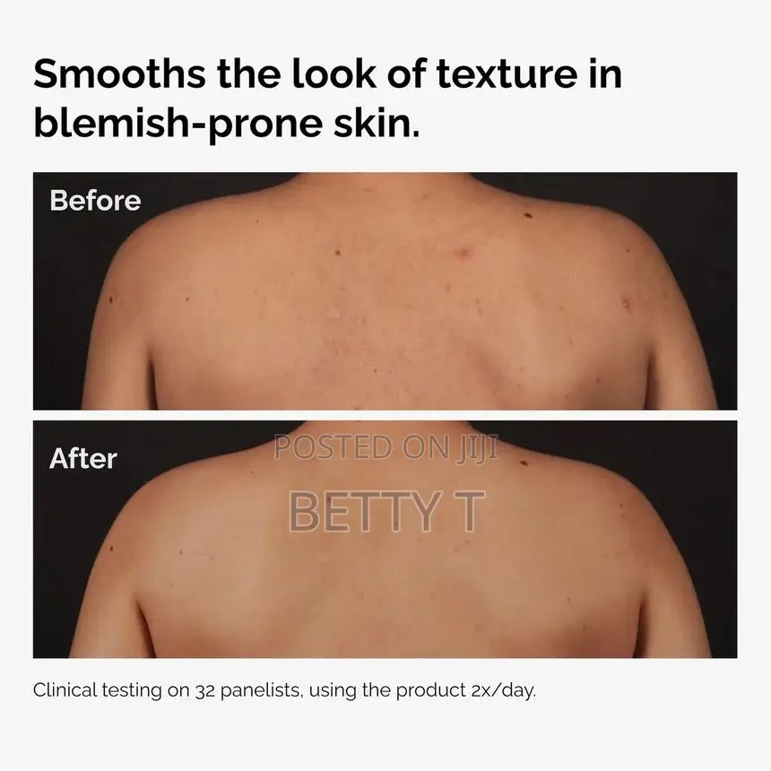 The Ordinary Salicylic Acid 0.5% Body Serum