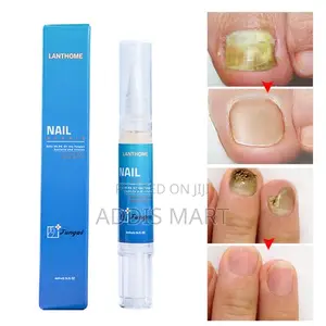 Photo - Lanthome Nail Repair