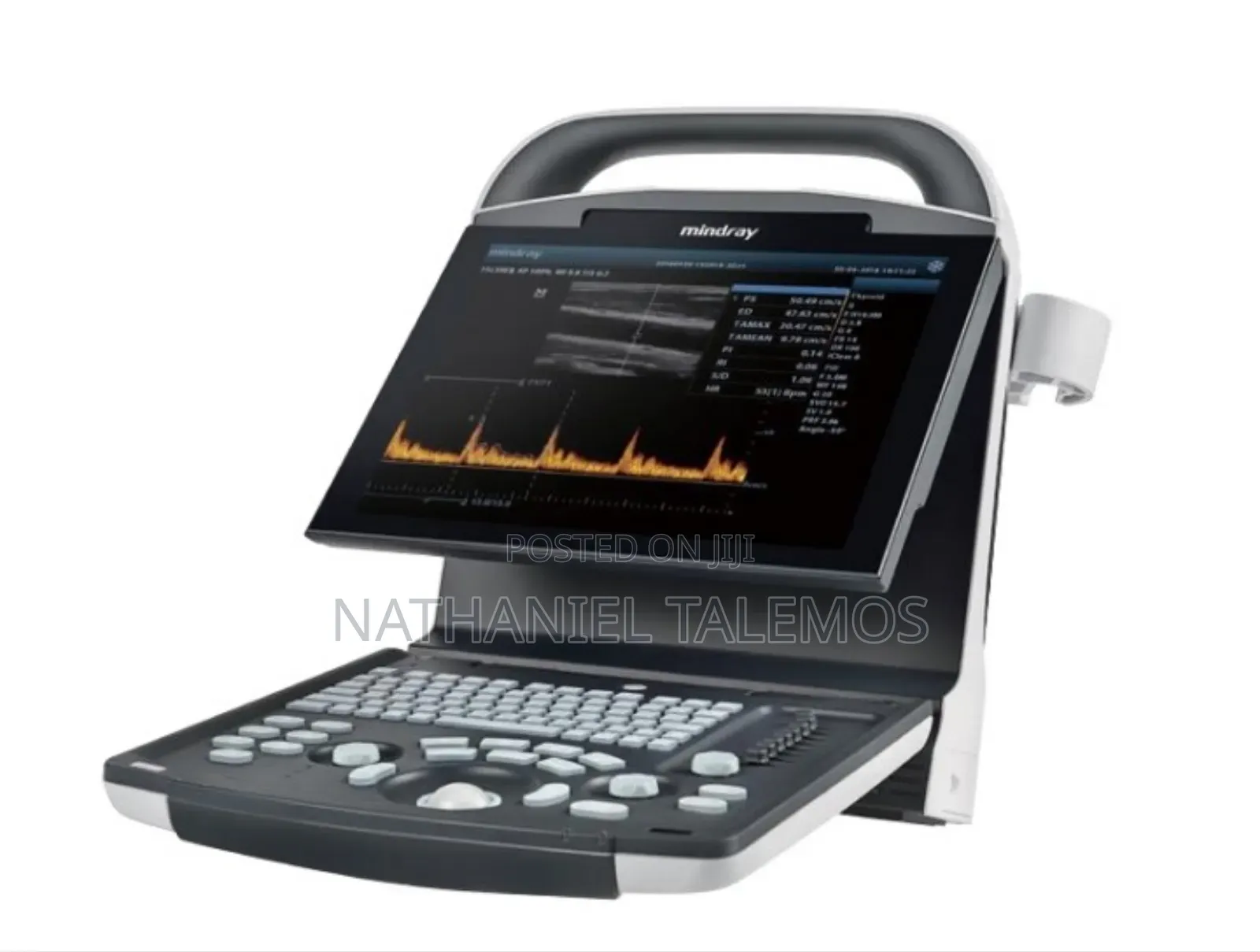 Dp-15 Digital Ultrasonic Diagnostic Imaging System