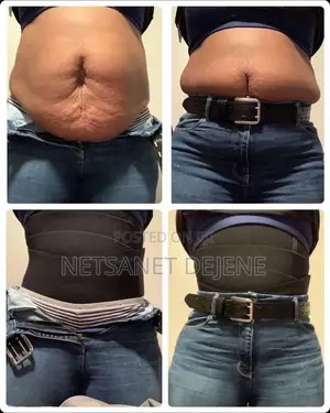 5 Meters Waist Training Corset. ውፍረት መቀነሻ