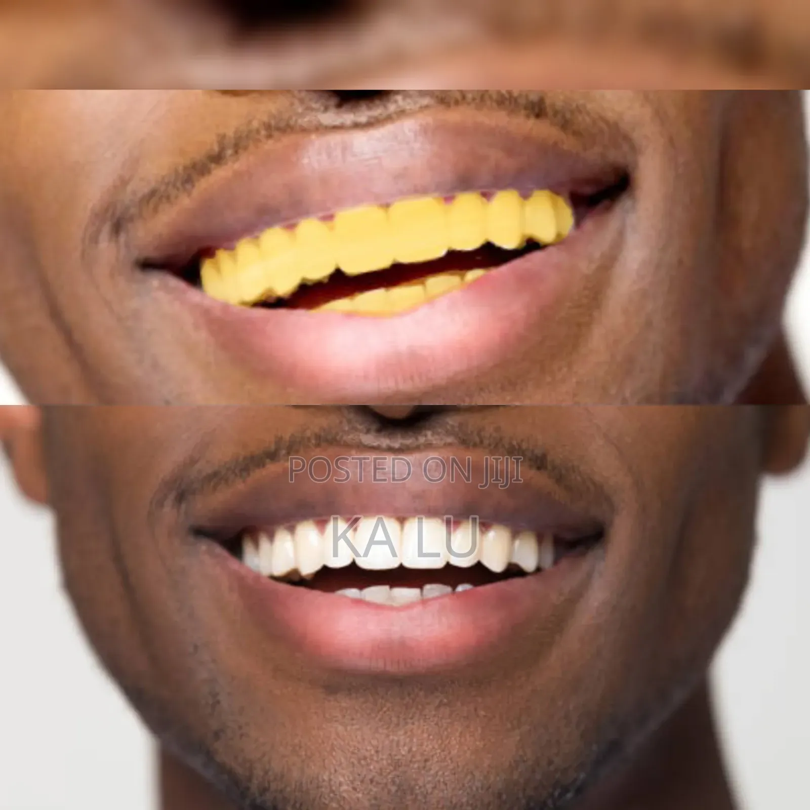 Lanbena Teeth Whitening Mousse