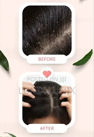 Anti Dandruff Shampoo