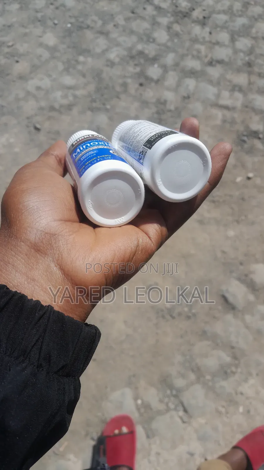 Minoxidil From America