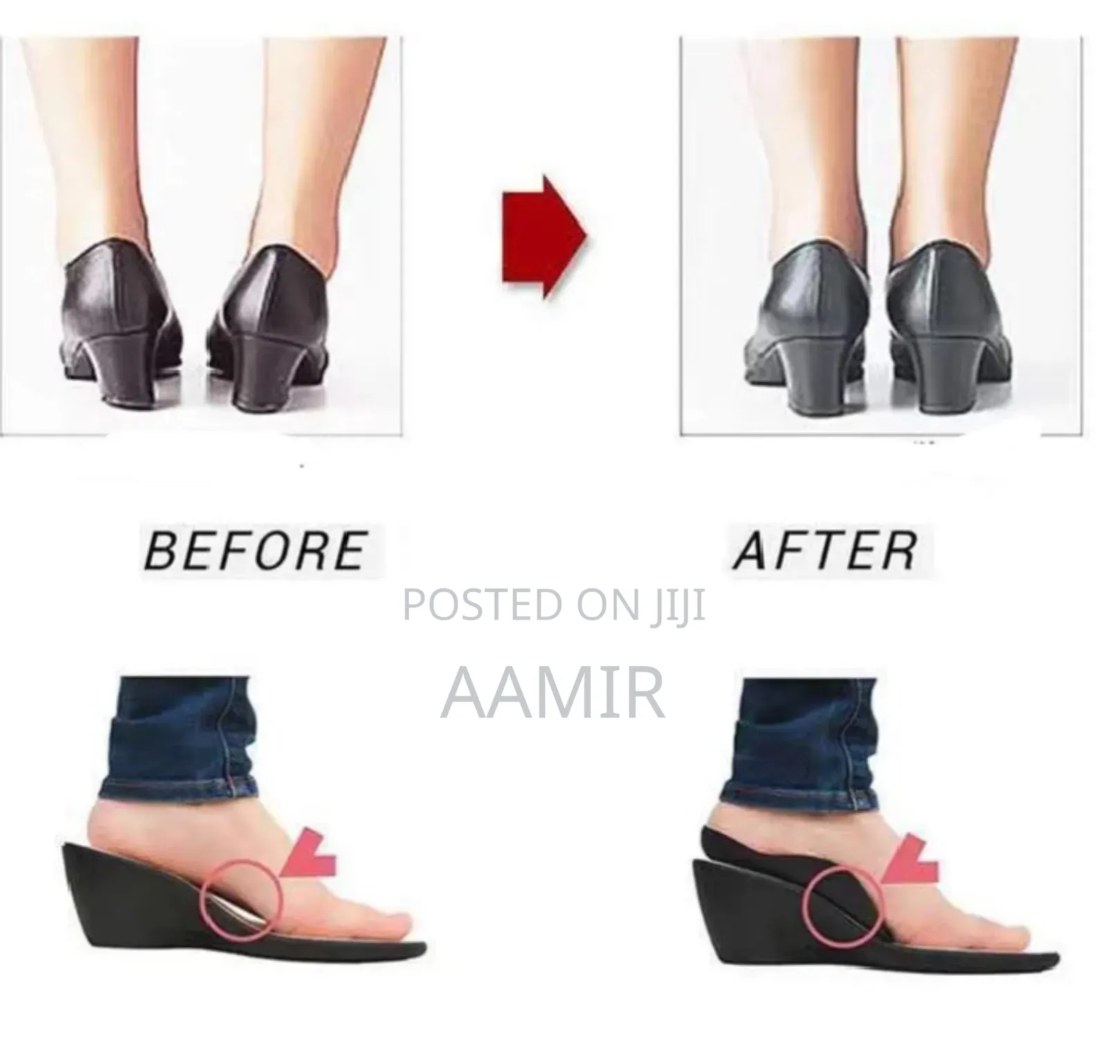 Insole Corrector