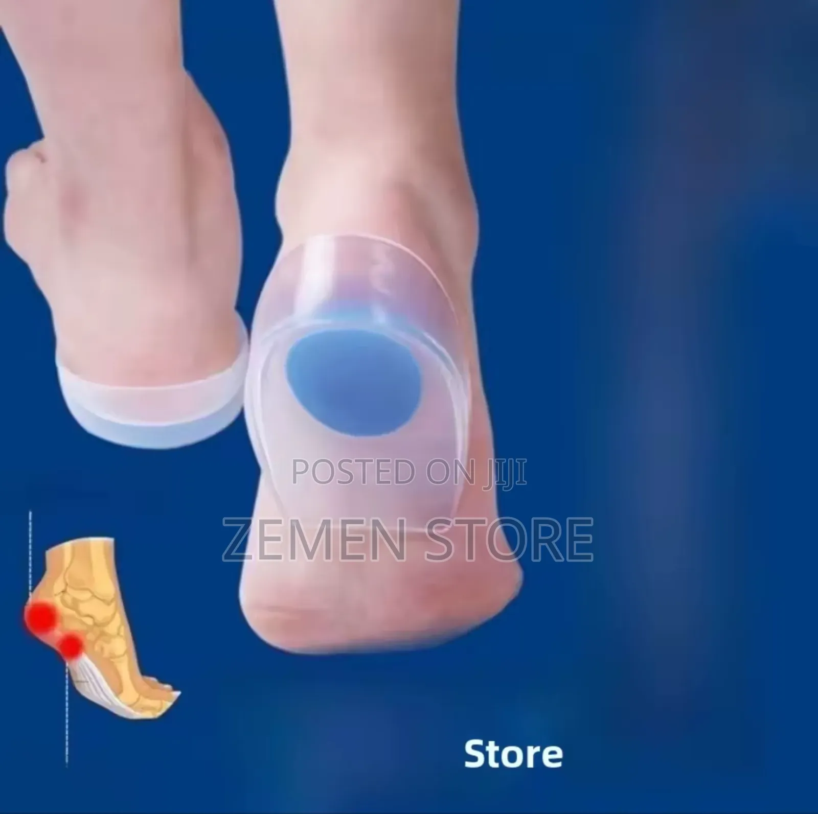 የተረከዝ ህመም ማስታገሻ | Silicone Gel Heel Cup Pad for Pain Relief