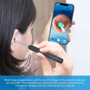 Wireless Visible Ear Cleaner