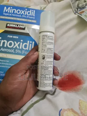 Minoxidil.