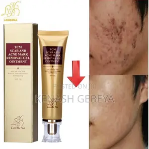 TCM Scar and Acne Removal GRL