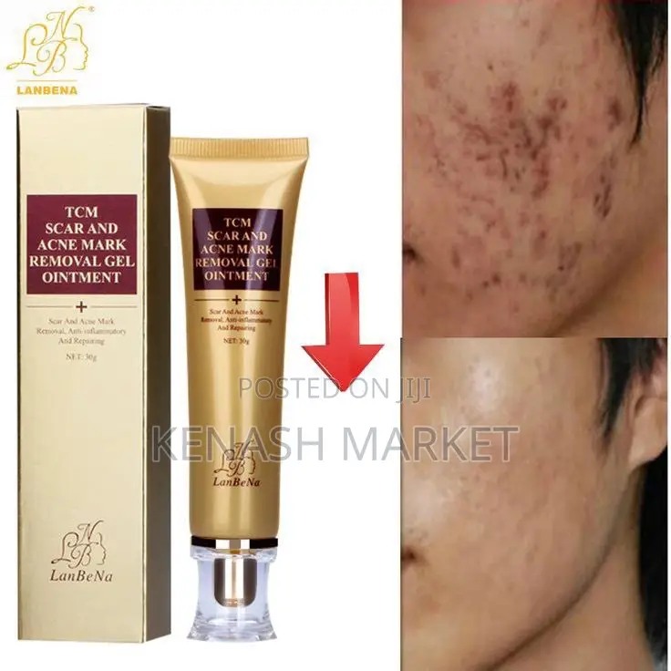 TCM Scar and Acne Removal GRL