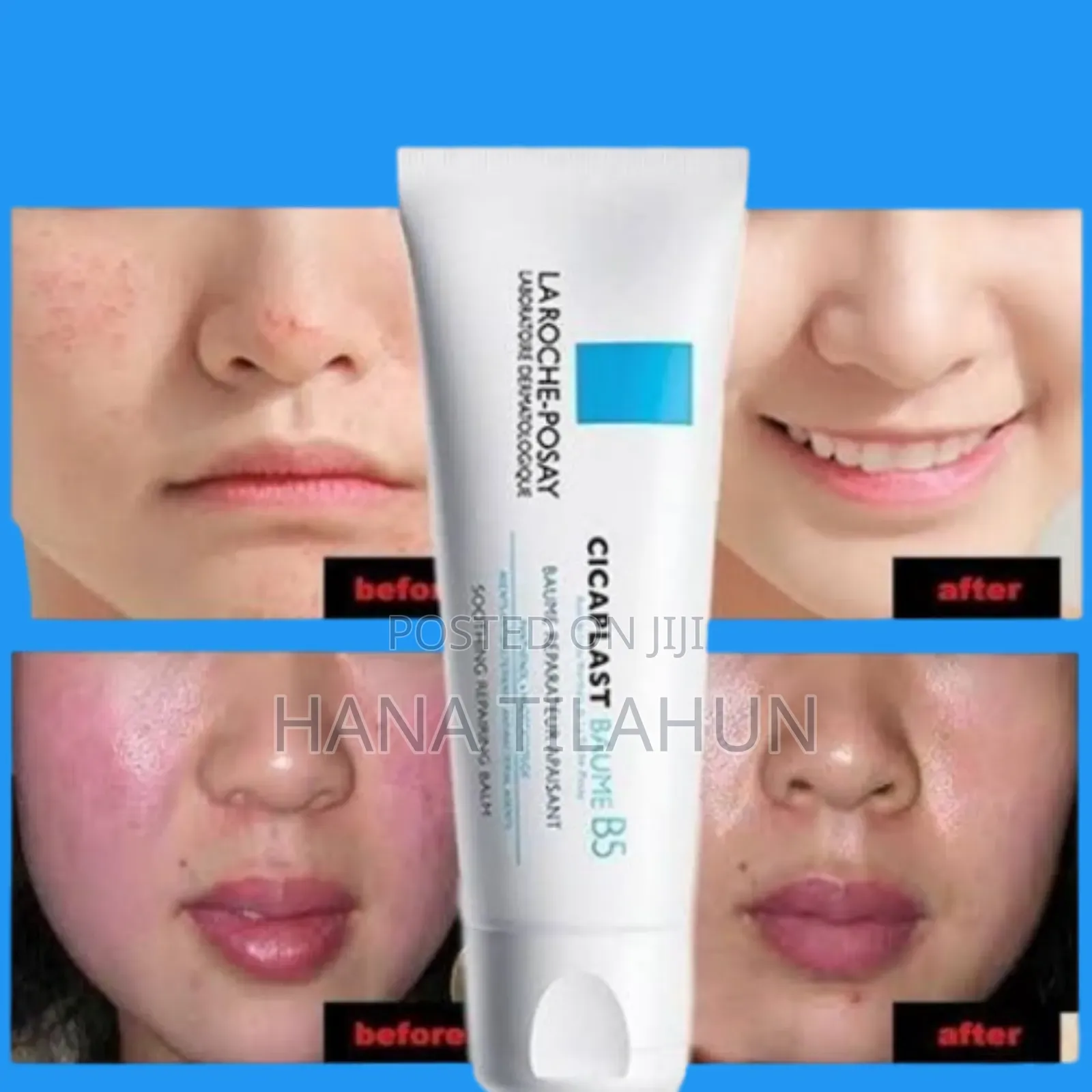 La Roche-Posay Cicaplast Balm B5 (100ml)