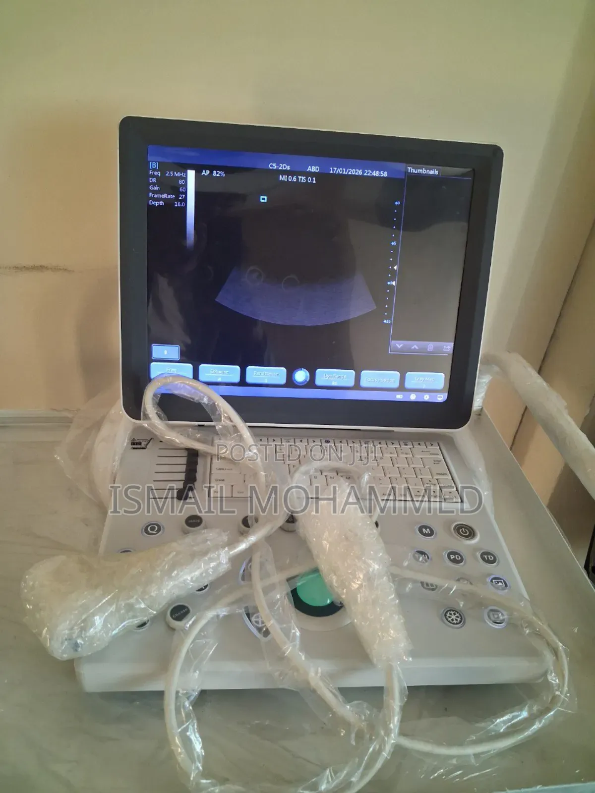 Teknova Ultrasound Machine