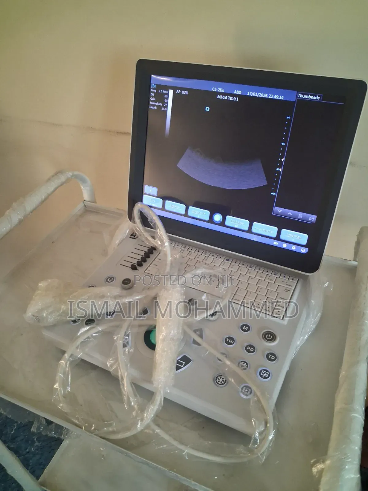 Teknova Ultrasound Machine