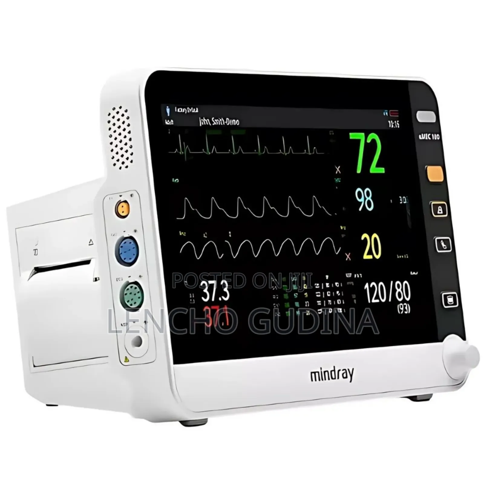 Patient Monitor Umec