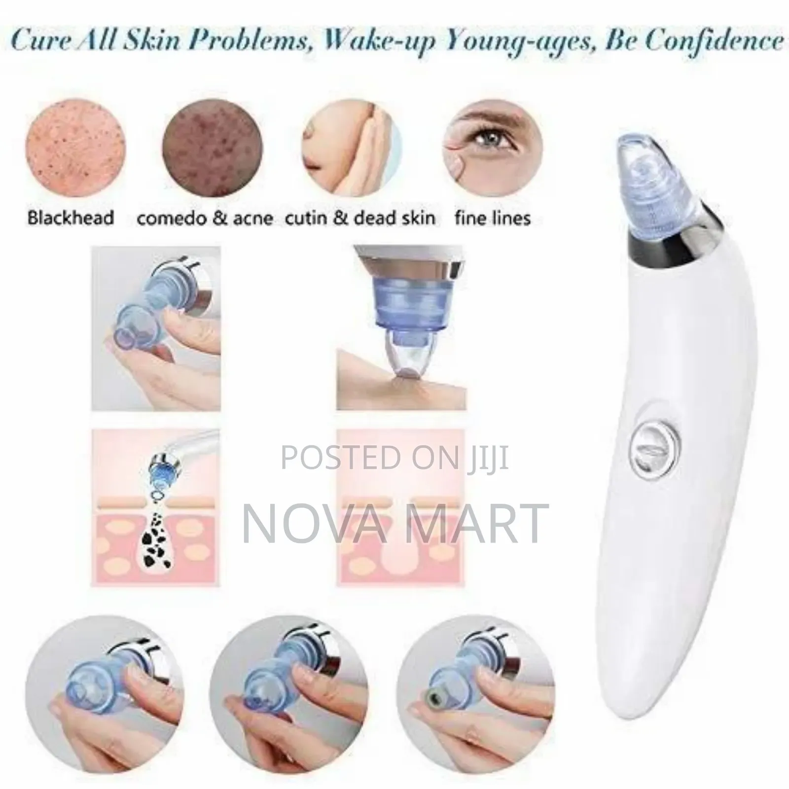 Facial Vacuum Blackhead Acne Pore Skin Cleaner