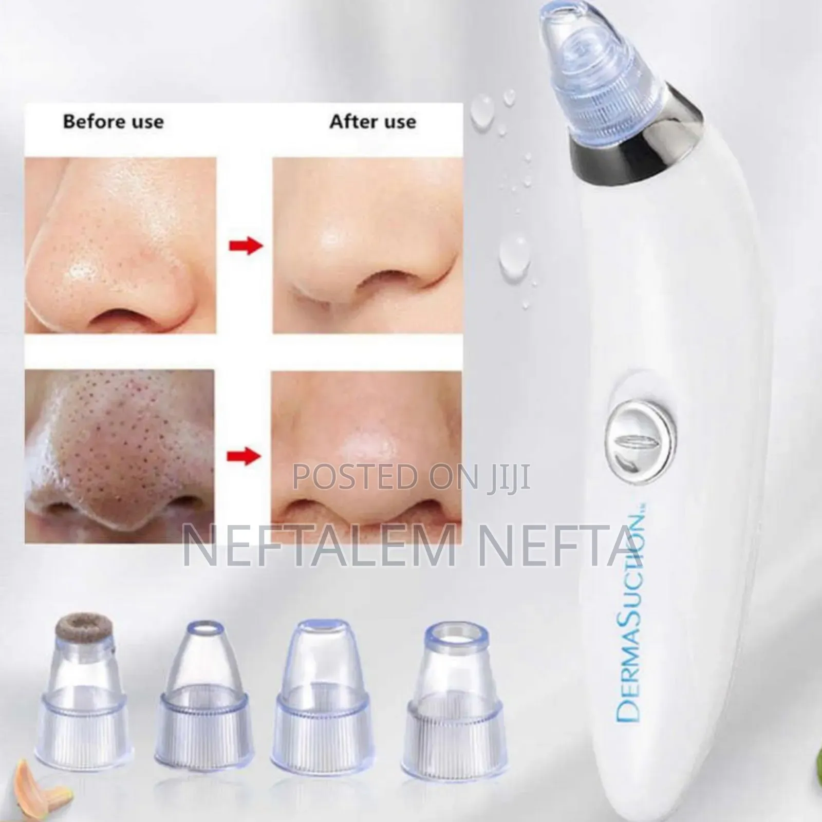 Facial Vacuum Blackhead Acne Pore Skin Cleaner