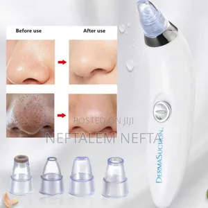 Facial Vacuum Blackhead Acne Pore Skin Cleaner