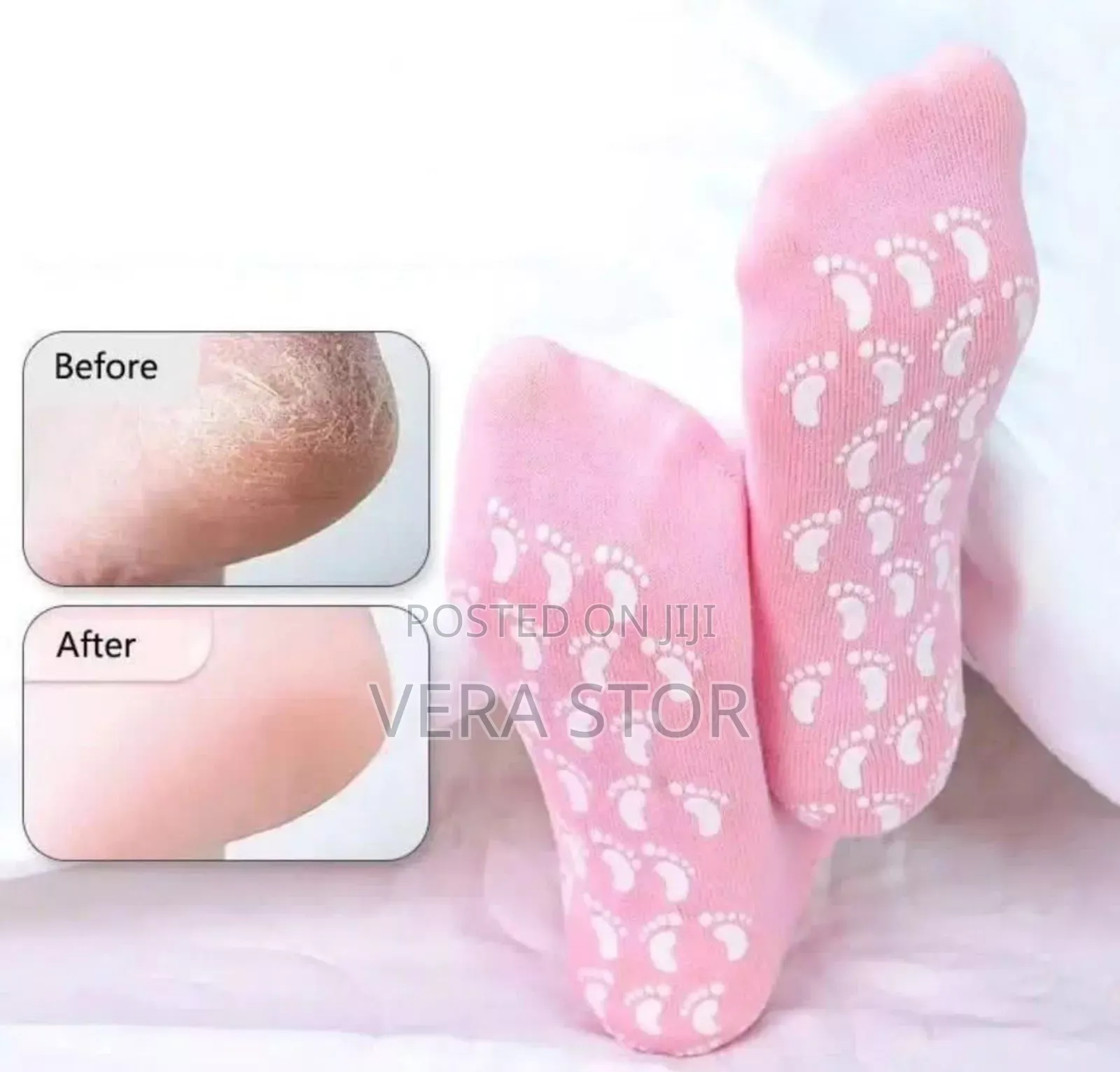 Spa or Moisturizing Gel Socks