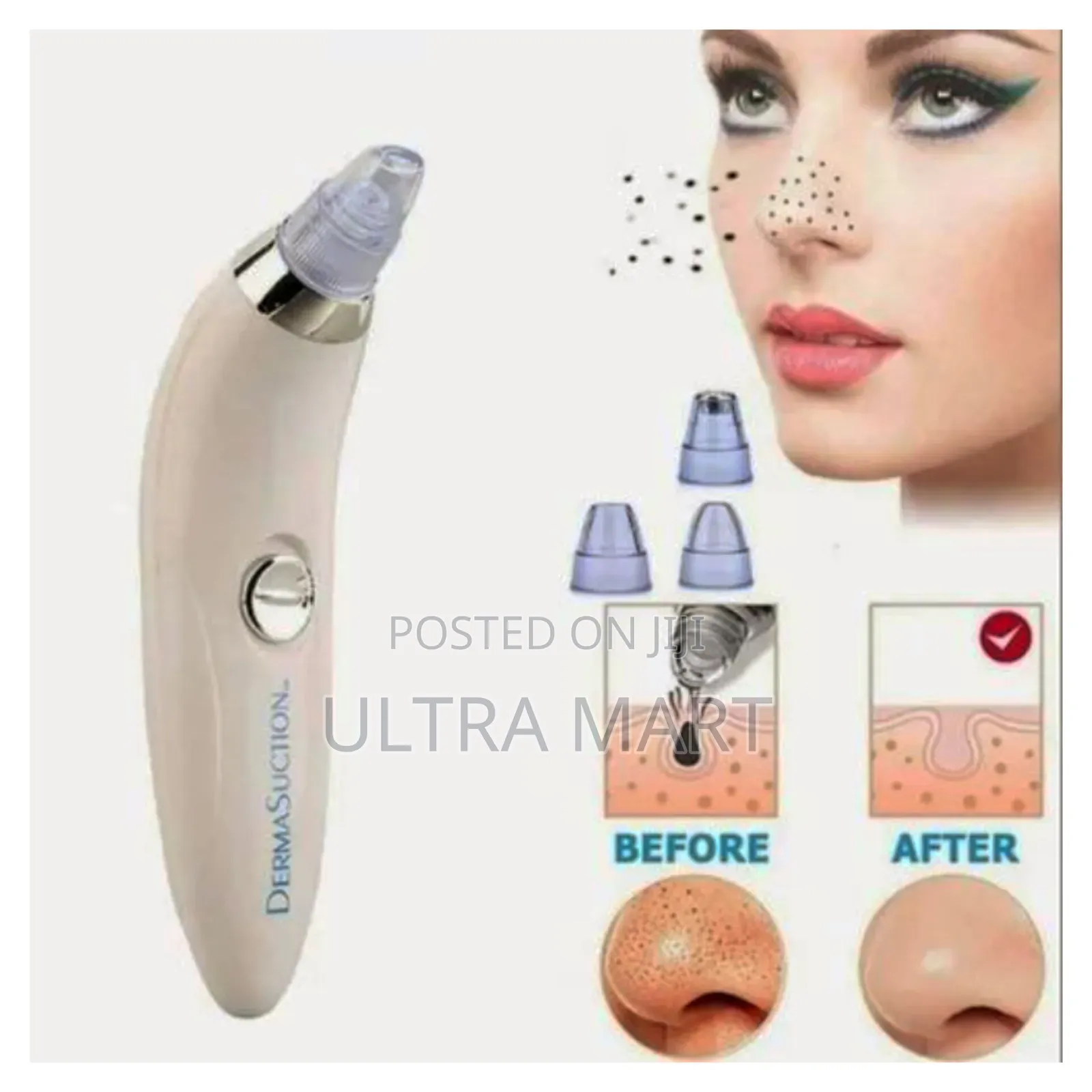 Facial Vacuum Blackhead Acne Pore Skin Cleaner