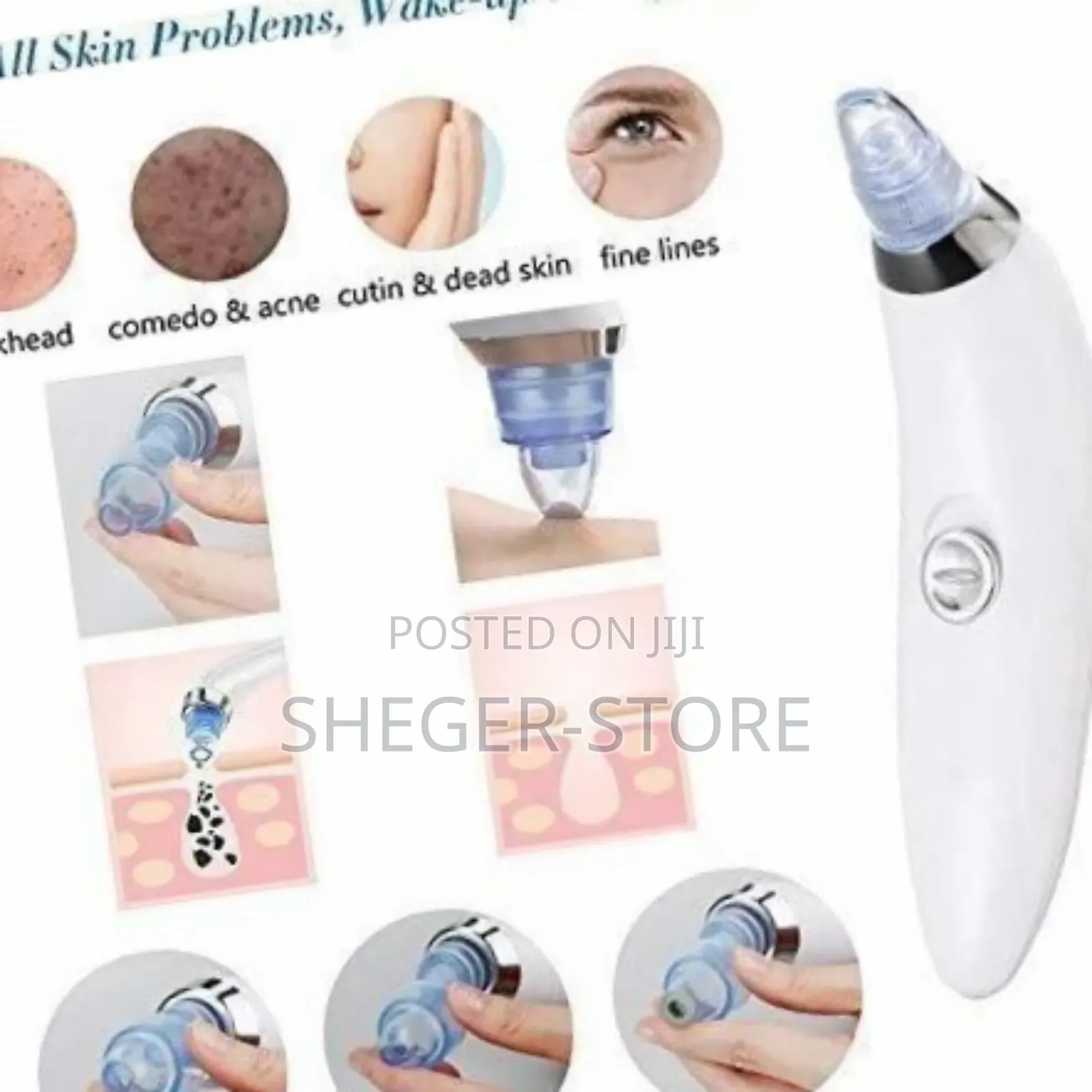 Orginal Facial Vacuum Blackhead Acne Pore Skin Cleaner