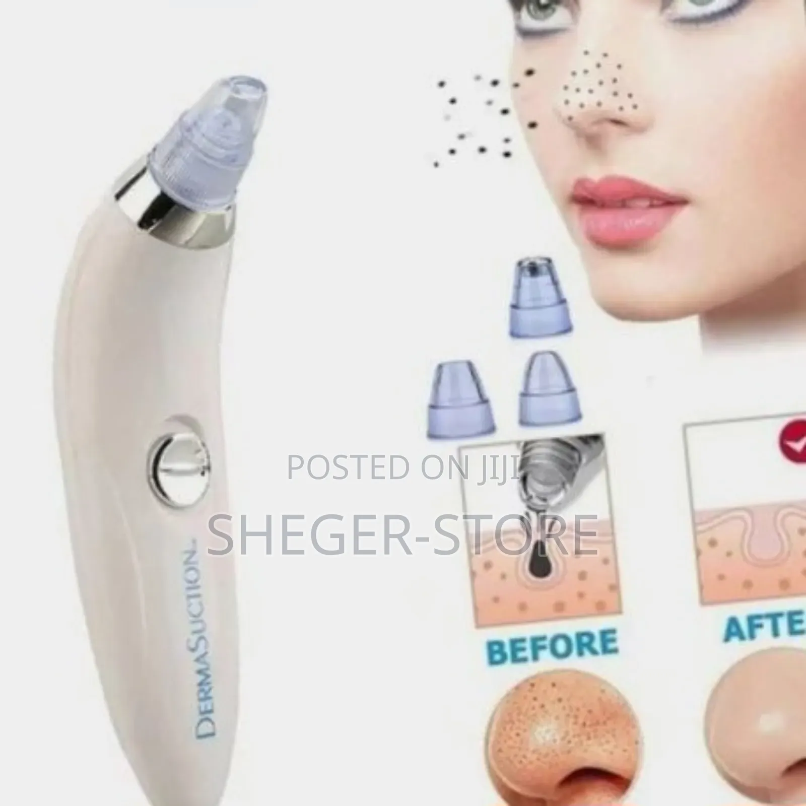 Orginal Facial Vacuum Blackhead Acne Pore Skin Cleaner