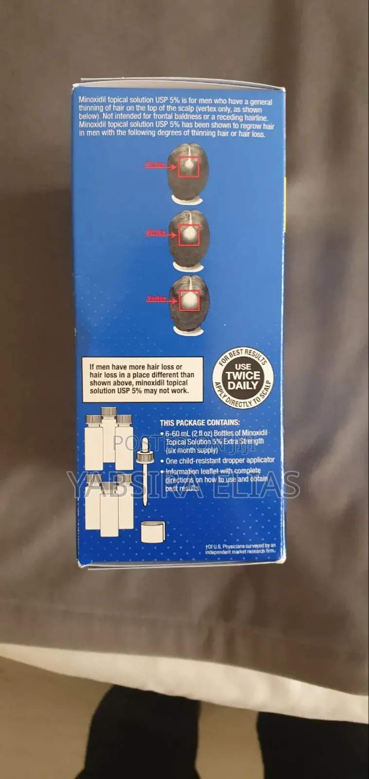 Minoxidil Hair Growth