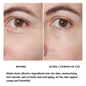 Some by Mi Aha Bha Pha 30 Days Miracle Toner