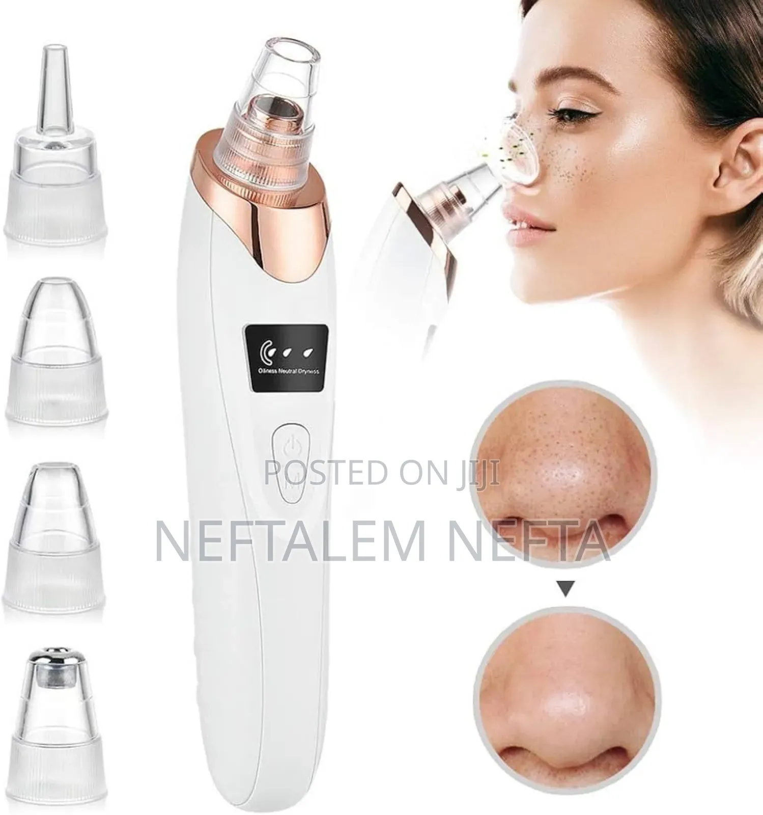 Multifunctional Blackhead Remover