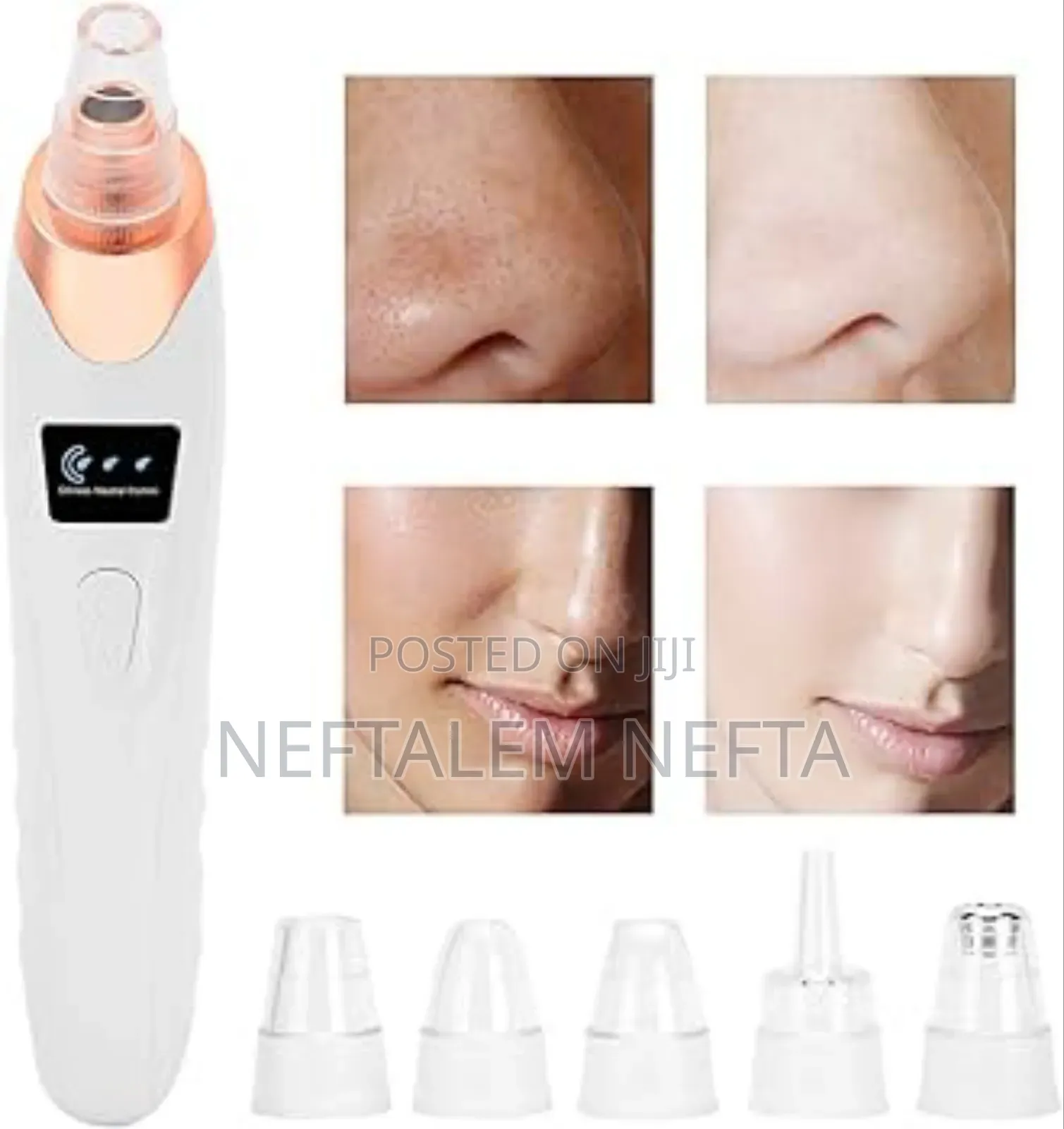 Multifunctional Blackhead Remover