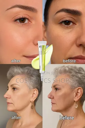 Celimax Antiging የሚሸበሸብ ቆዳን የሚያስተካክል