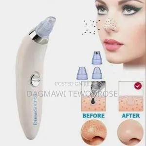 Facial Vacuum Blackhead Acne Pore Skin Cleaner