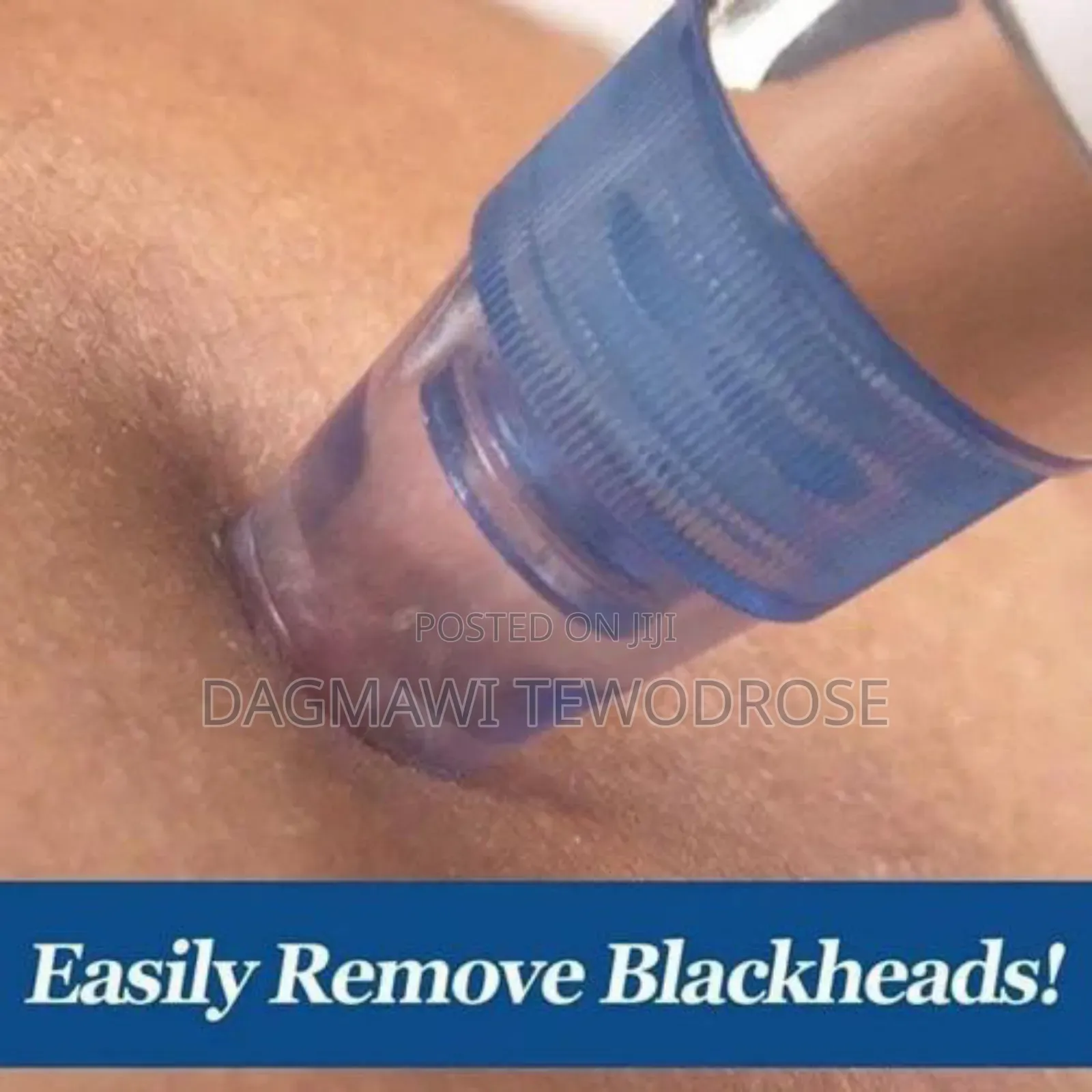 Facial Vacuum Blackhead Acne Pore Skin Cleaner