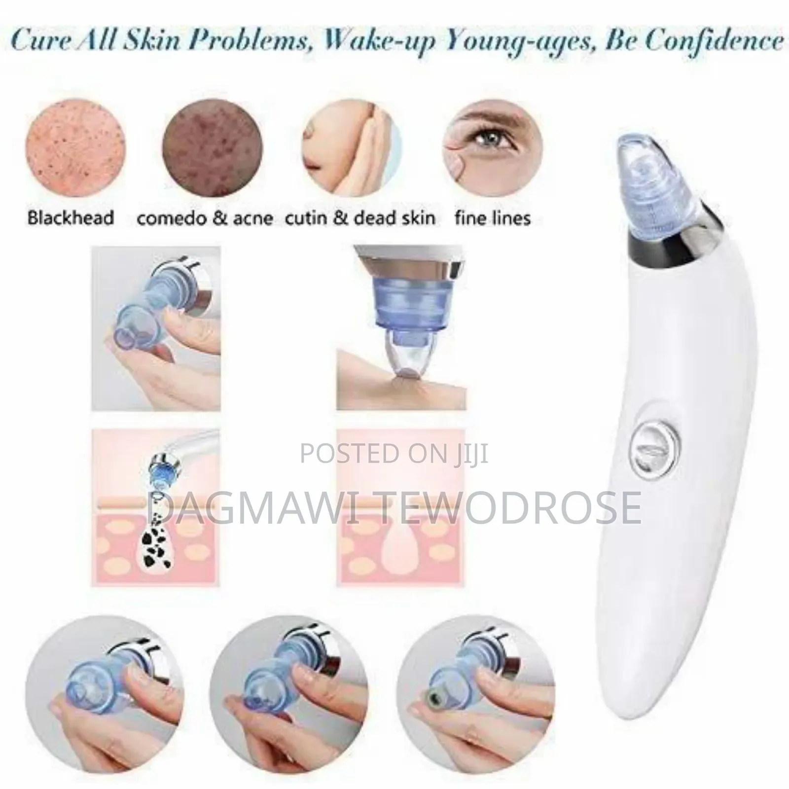 Facial Vacuum Blackhead Acne Pore Skin Cleaner