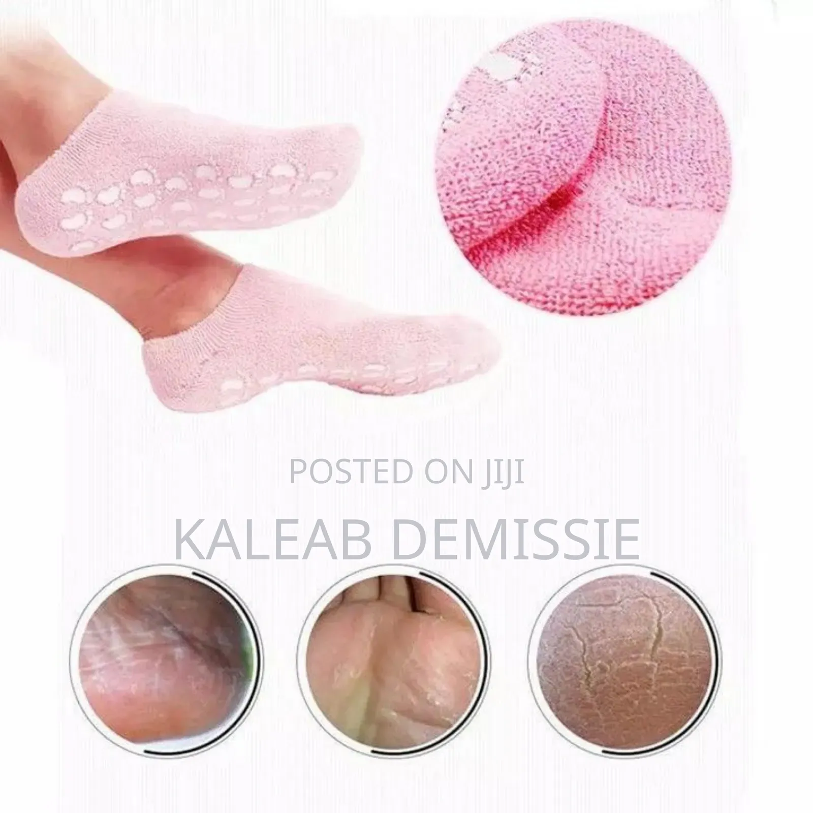 Soft Moisturizing Gel Socks Foot Care ለእግር ልስላሴ