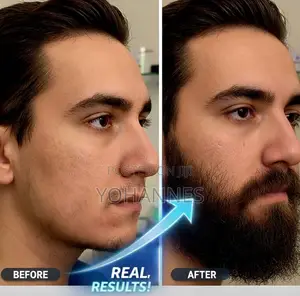 Original Liquid Minoxidil – Fast Hair Regrowth Solution